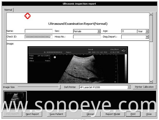 ultrasound equipment Touch Screen